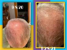 Load image into Gallery viewer, Jump Start Liquid Goldz Hair Growth Solution