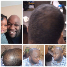 Load image into Gallery viewer, Jump Start Liquid Goldz Hair Growth Solution