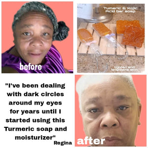 Tumeric & Kojic Acid Soap & Clarifying Facial Moisturizer